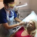 Botox around eyes